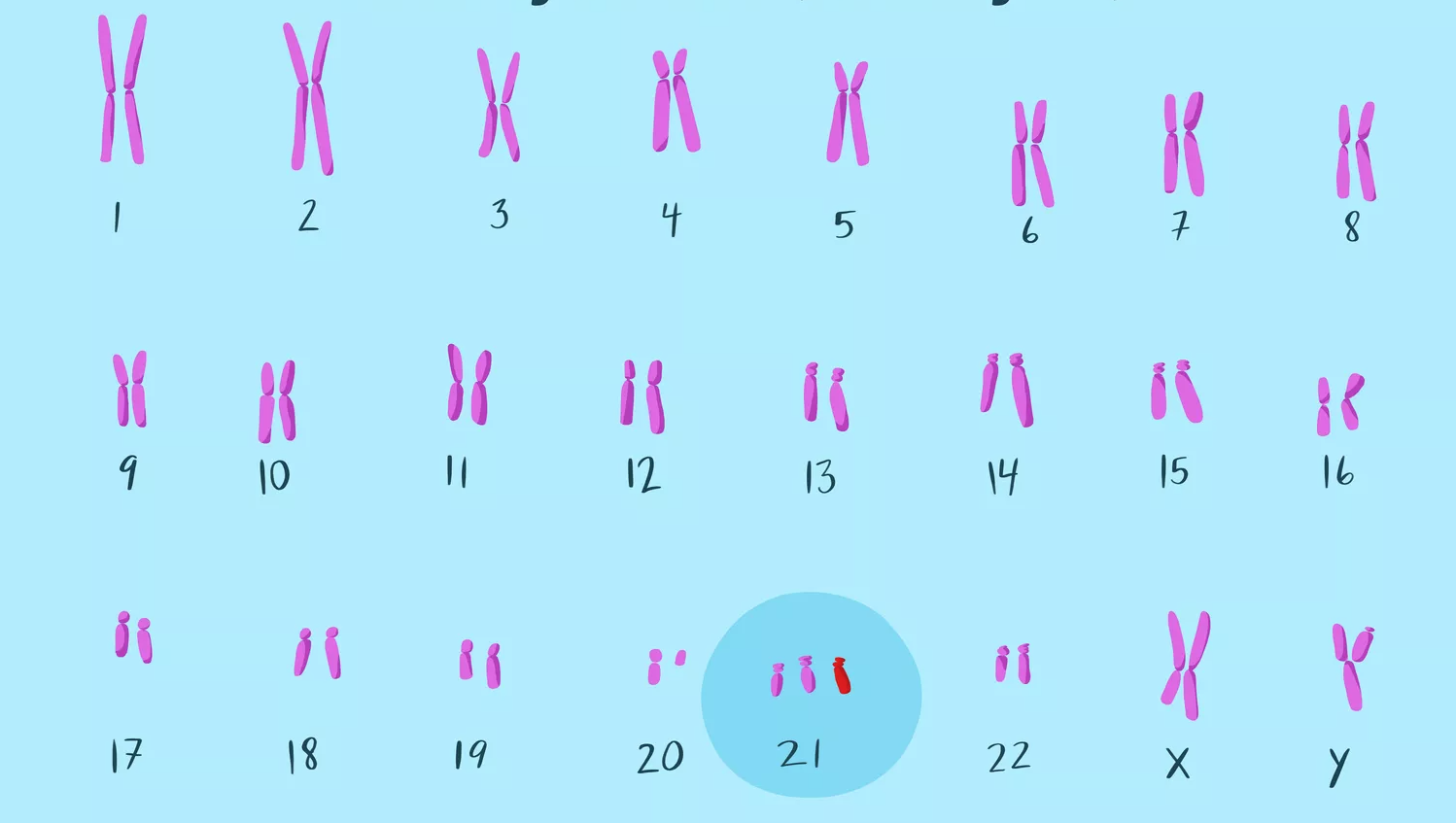 downi kromosoomid